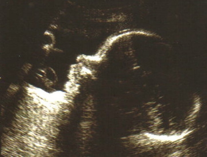 Diving during pregnancy an ongoing issue. The medical point of view • Mares Scuba Diving Blog